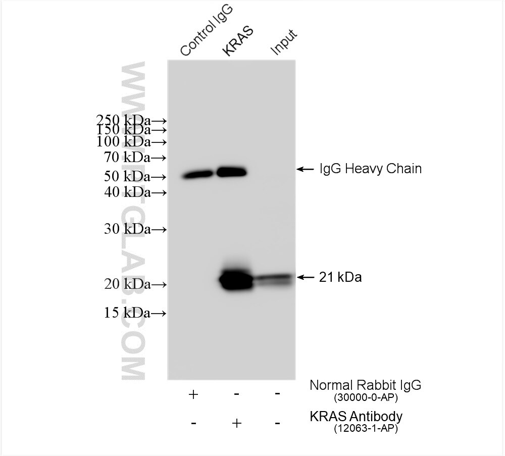 IP experiment of HeLa using 12063-1-AP