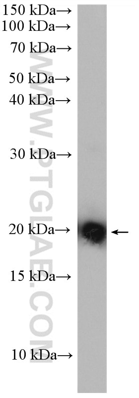 Western Blot (WB) analysis of A549 cells using KRAS Polyclonal antibody (12063-1-AP)