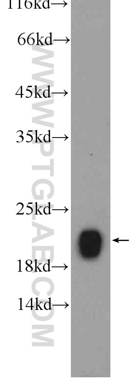 Western Blot (WB) analysis of rat kidney tissue using KRAS Polyclonal antibody (12063-1-AP)