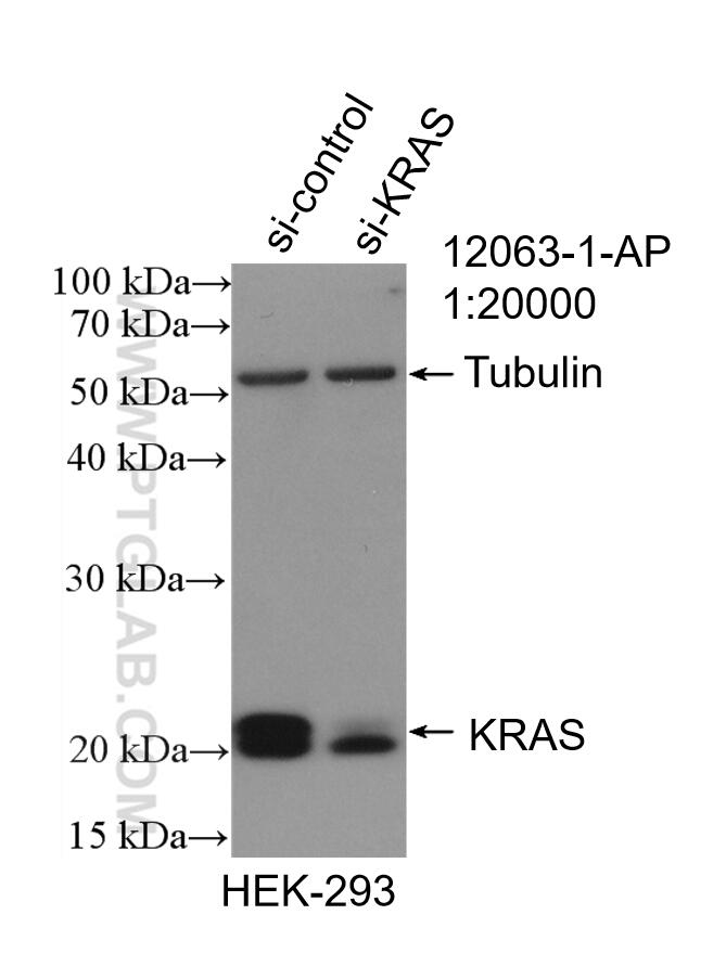 Western Blot (WB) analysis of HEK-293 cells using KRAS Polyclonal antibody (12063-1-AP)
