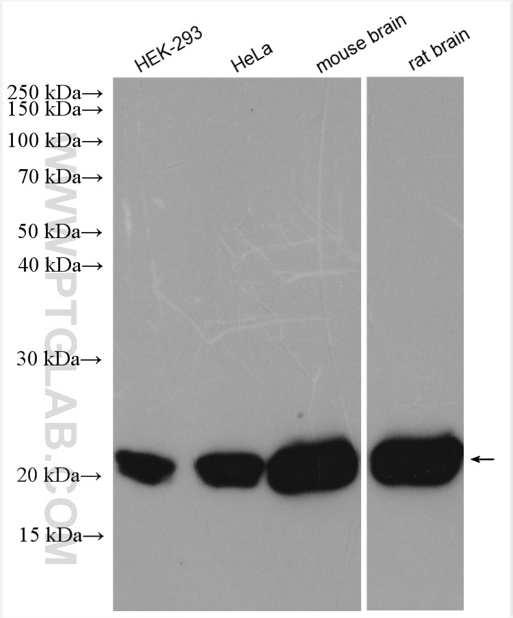 Western Blot (WB) analysis of various lysates using KRAS Polyclonal antibody (12063-1-AP)