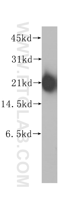 Western Blot (WB) analysis of human brain tissue using KRAS Polyclonal antibody (12063-1-AP)