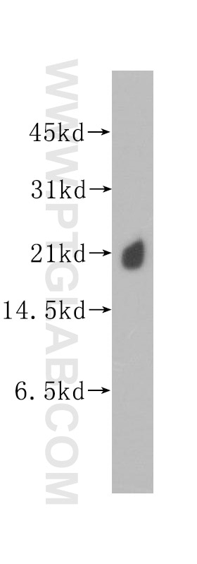 Western Blot (WB) analysis of human kidney tissue using KRAS Polyclonal antibody (12063-1-AP)