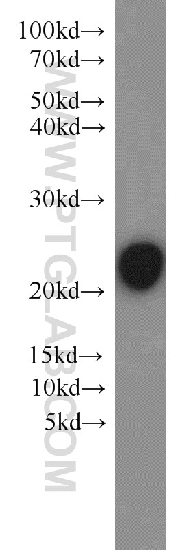 KRAS Polyclonal antibody