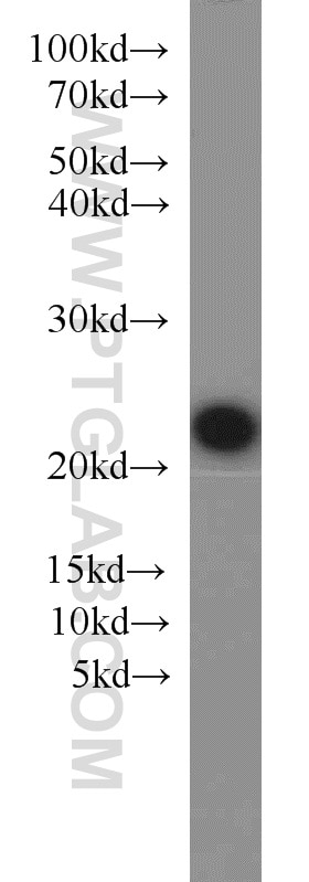 Western Blot (WB) analysis of mouse kidney tissue using KRAS Polyclonal antibody (12063-1-AP)