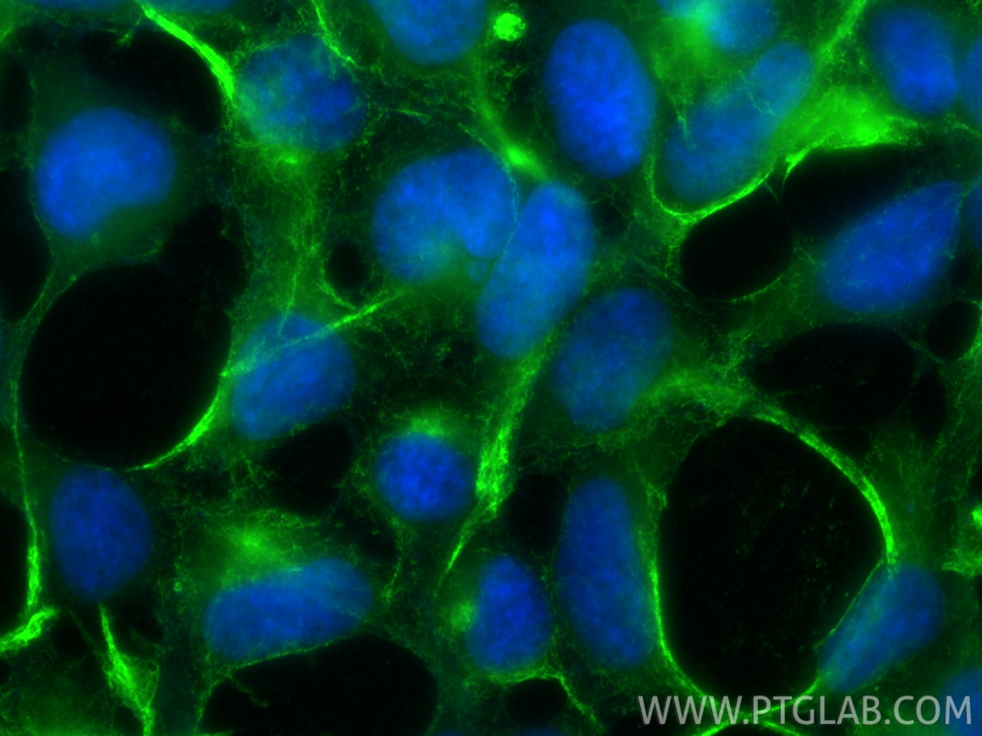 Immunofluorescence (IF) / fluorescent staining of HEK-293 cells using pan Ras Monoclonal antibody (60309-1-Ig)