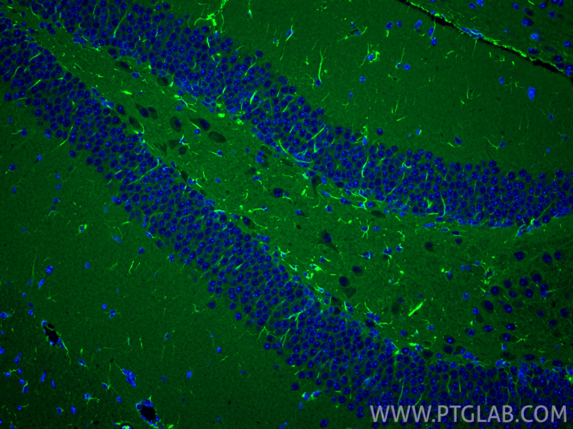 Immunofluorescence (IF) / fluorescent staining of mouse brain tissue using pan Ras Monoclonal antibody (60309-1-Ig)