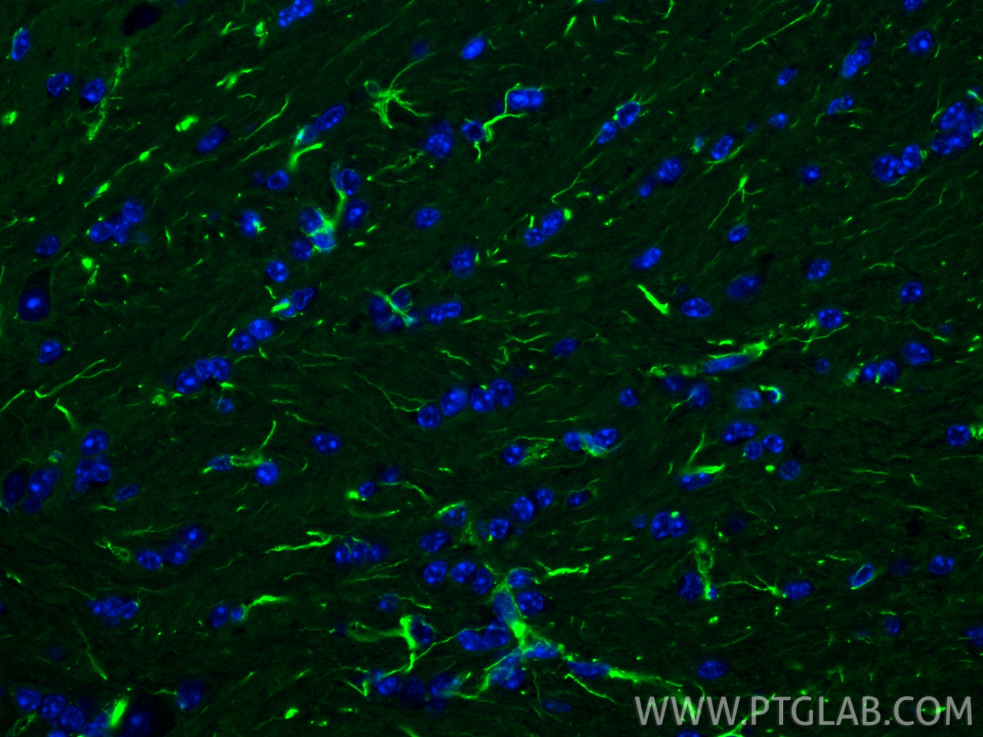 Immunofluorescence (IF) / fluorescent staining of mouse brain tissue using pan Ras Monoclonal antibody (60309-1-Ig)