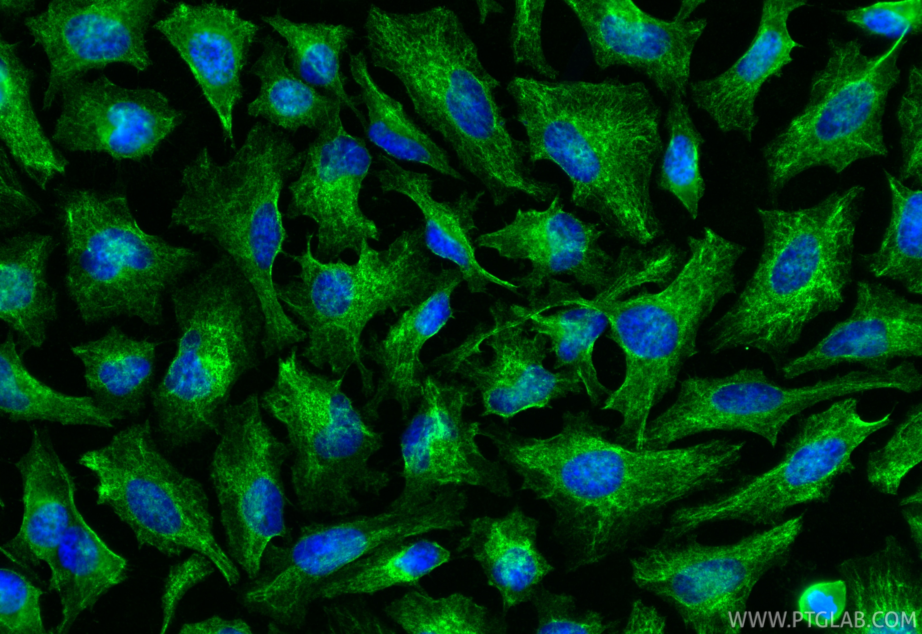Immunofluorescence (IF) / fluorescent staining of HeLa cells using pan Ras Monoclonal antibody (60309-1-Ig)