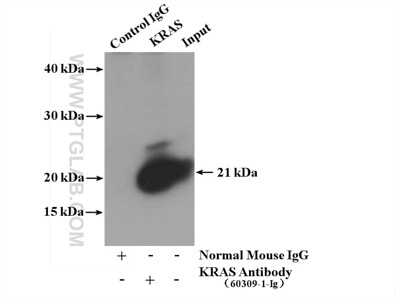 Immunoprecipitation (IP) experiment of mouse brain tissue using pan Ras Monoclonal antibody (60309-1-Ig)