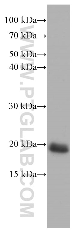 Western Blot (WB) analysis of HEK-293 cells using pan Ras Monoclonal antibody (60309-1-Ig)