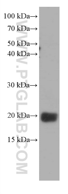 Western Blot (WB) analysis of Neuro-2a cells using pan Ras Monoclonal antibody (60309-1-Ig)