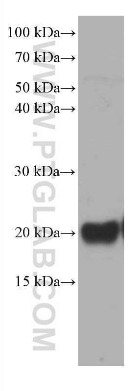 Western Blot (WB) analysis of ROS1728 cells using pan Ras Monoclonal antibody (60309-1-Ig)