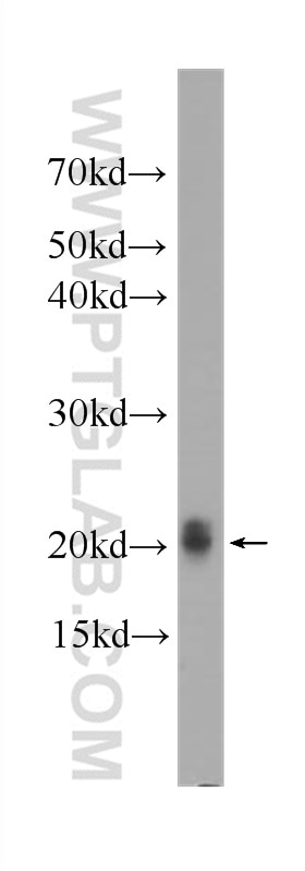 pan Ras Monoclonal antibody