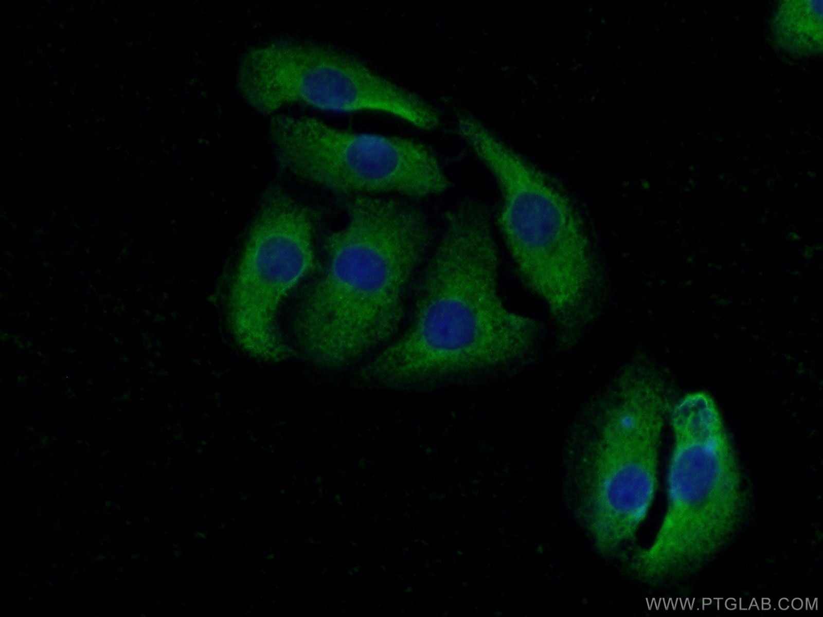 Immunofluorescence (IF) / fluorescent staining of SH-SY5Y cells using KRAS-2A-specific Polyclonal antibody (16156-1-AP)