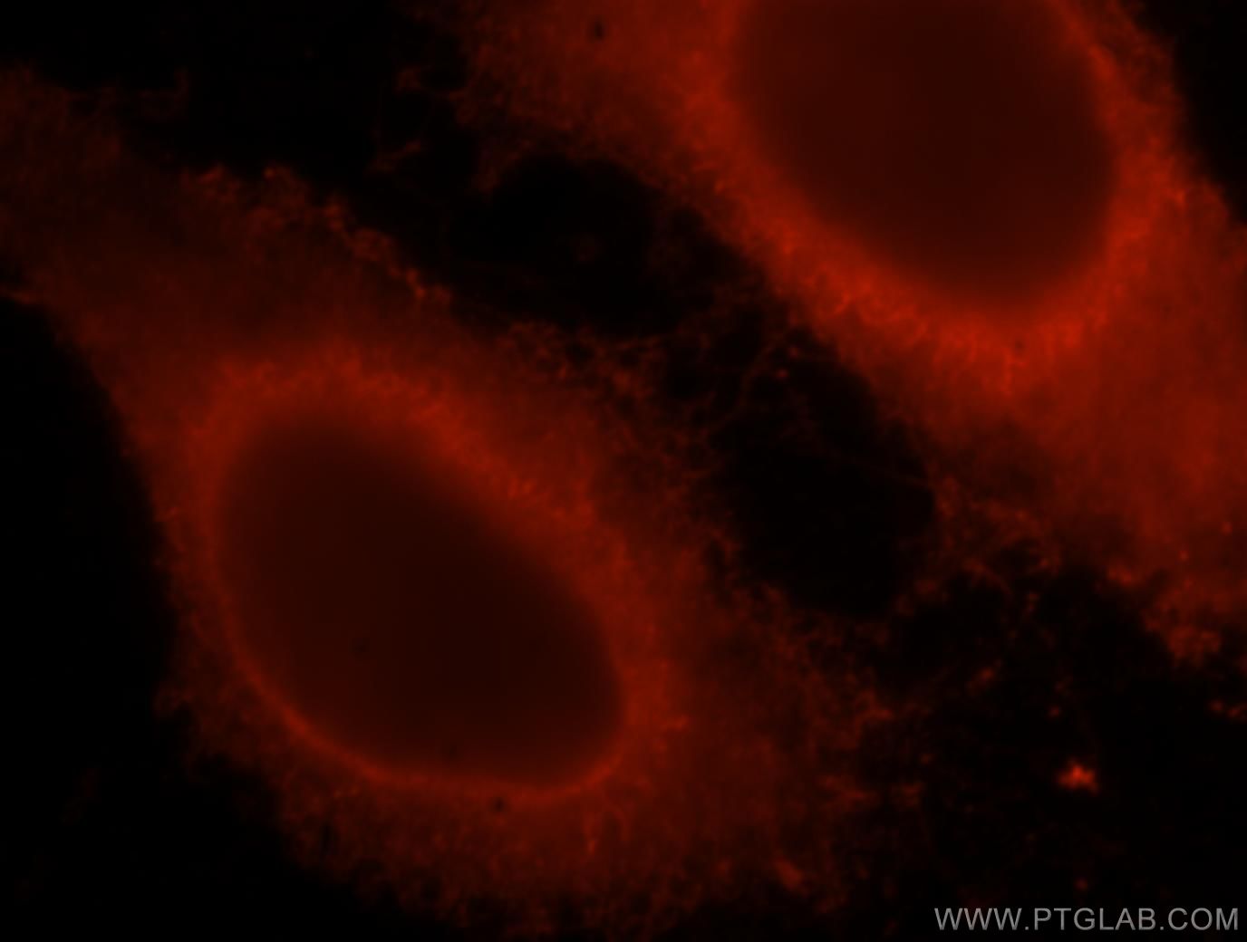 Immunofluorescence (IF) / fluorescent staining of HepG2 cells using KRAS-2B-specific Polyclonal antibody (18294-1-AP)