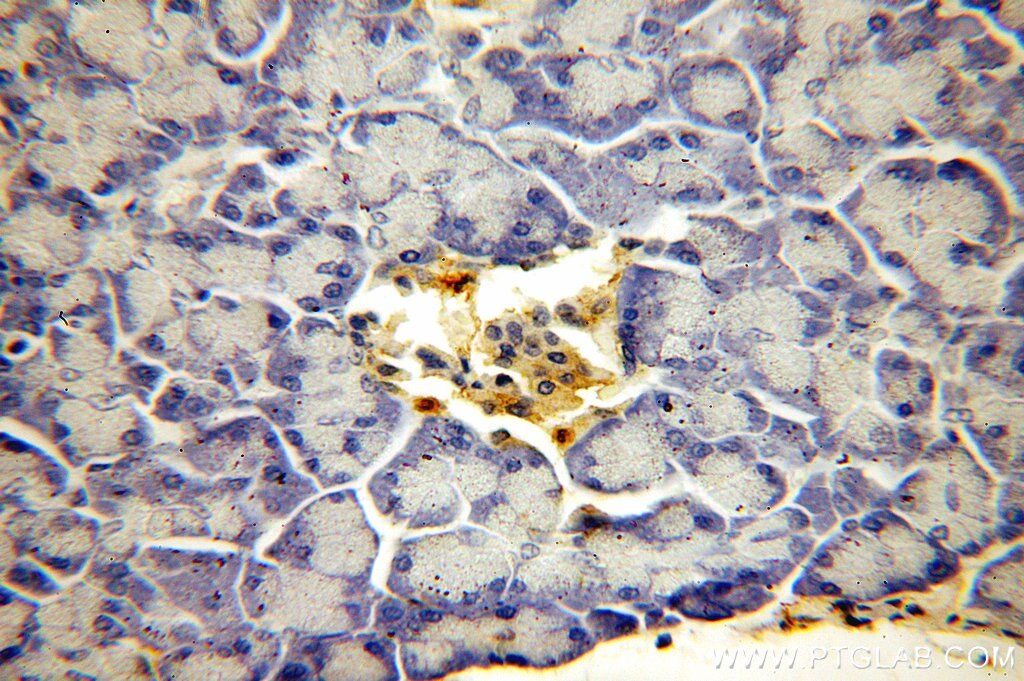 Immunohistochemistry (IHC) staining of human pancreas tissue using KRAS-2B-specific Polyclonal antibody (18294-1-AP)