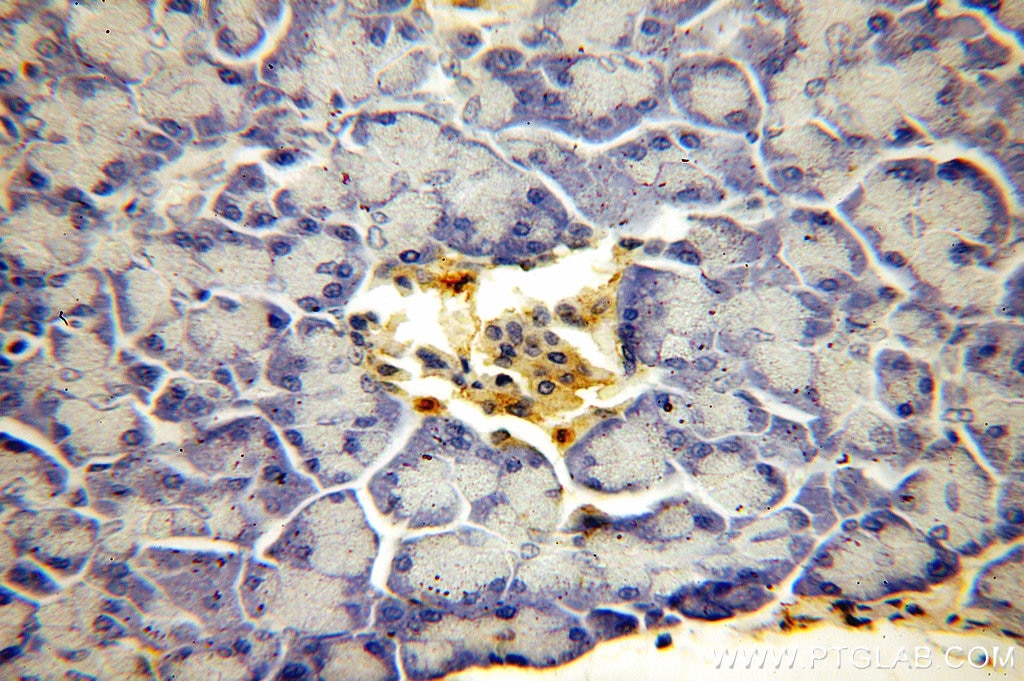 IHC staining of human pancreas using 18294-1-AP