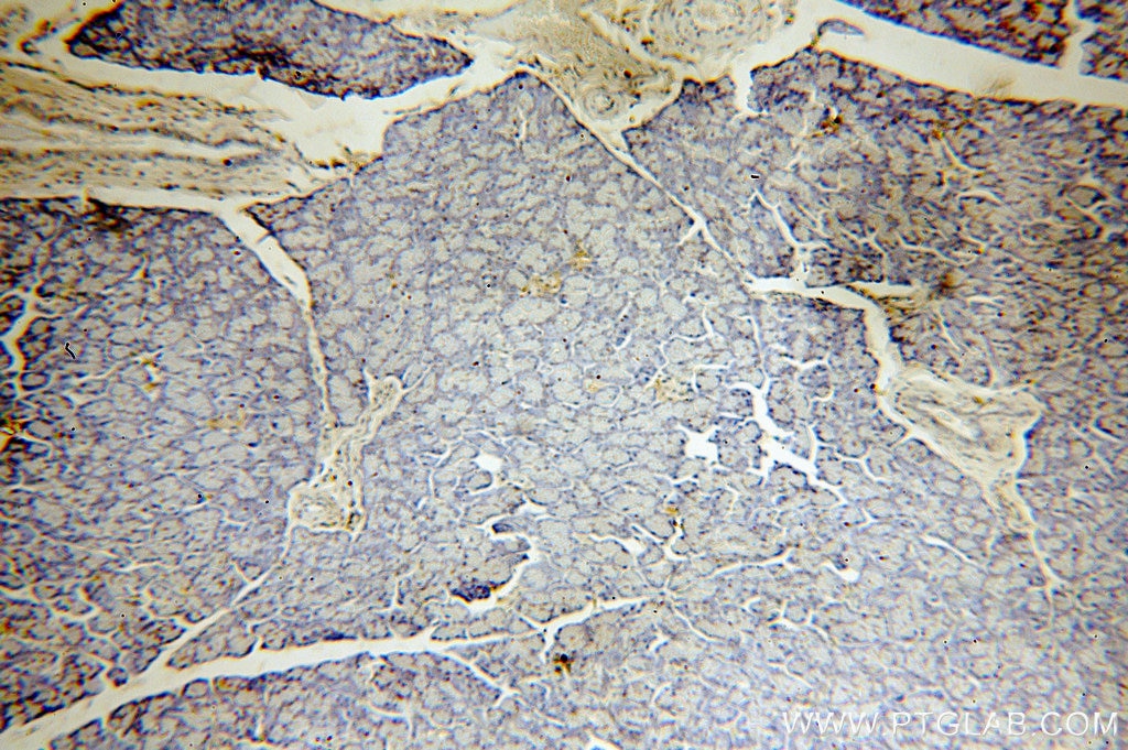 Immunohistochemistry (IHC) staining of human pancreas tissue using KRAS-2B-specific Polyclonal antibody (18294-1-AP)