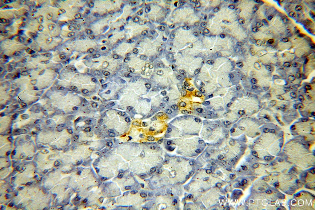 Immunohistochemistry (IHC) staining of human pancreas tissue using KRAS-2B-specific Polyclonal antibody (18294-1-AP)