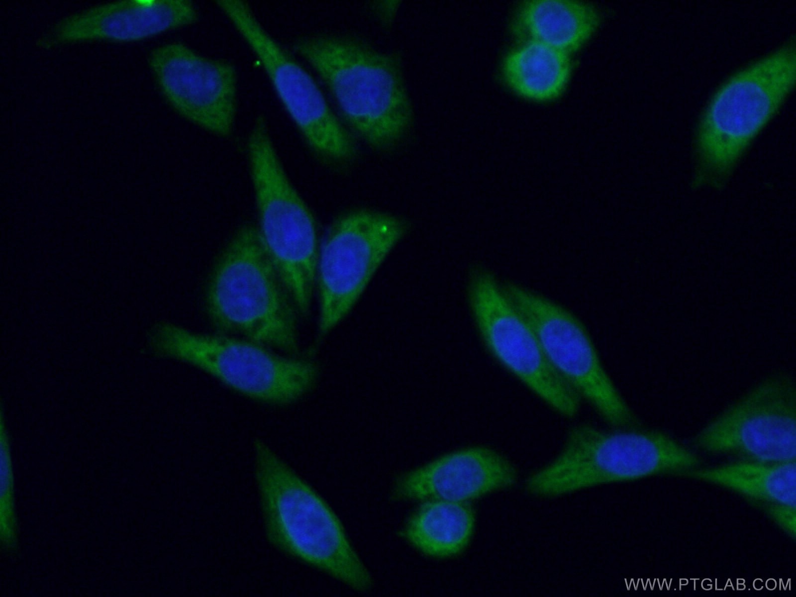 Immunofluorescence (IF) / fluorescent staining of HeLa cells using KRAS-2B-specific Polyclonal antibody (16155-1-AP)