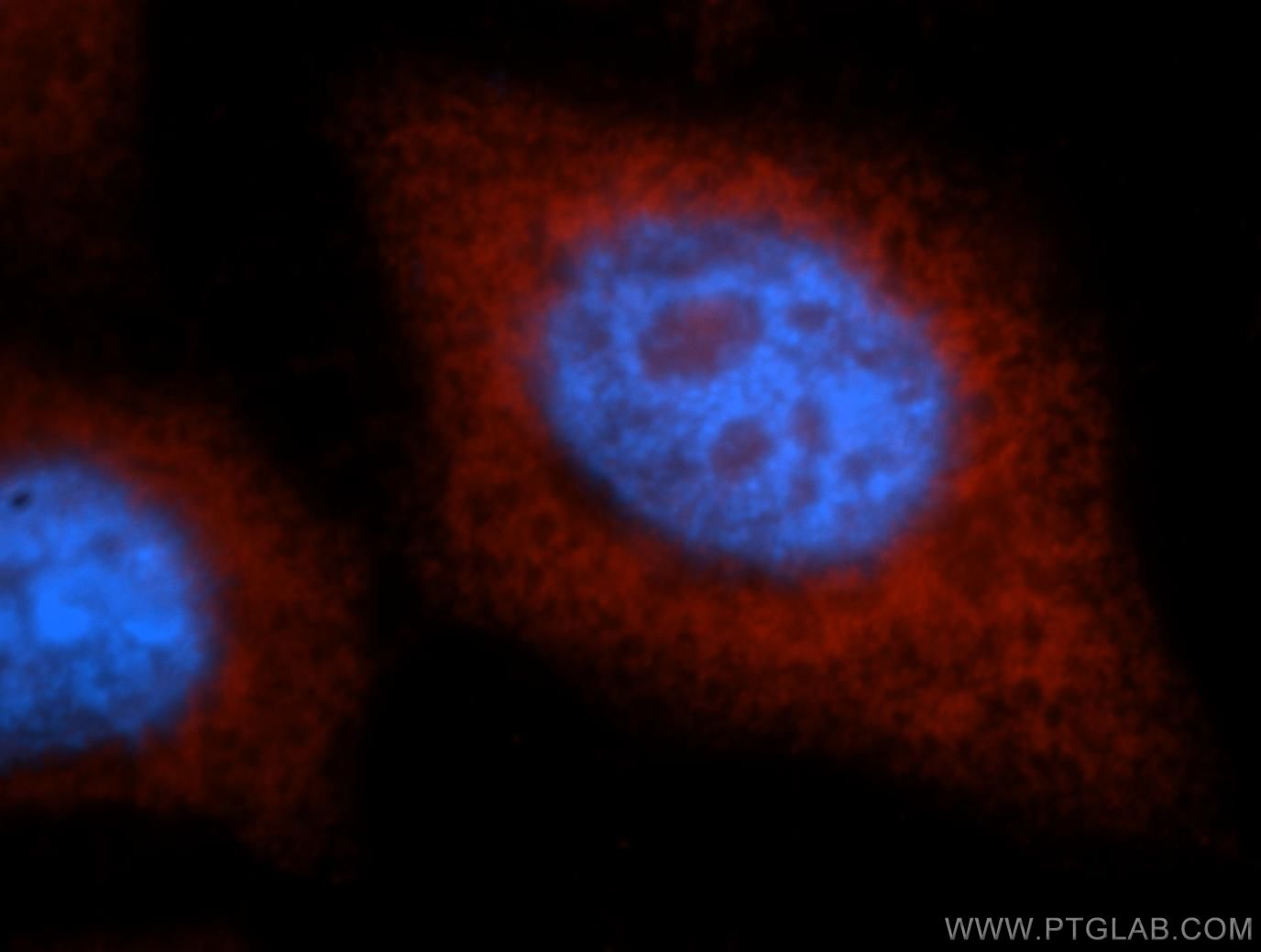 KRAS-2B-specific Polyclonal antibody