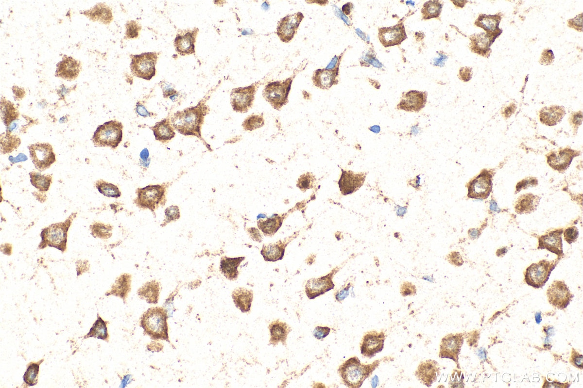 Immunohistochemistry (IHC) staining of rat brain tissue using KRAS-4B-specific Polyclonal antibody (16155-1-AP)