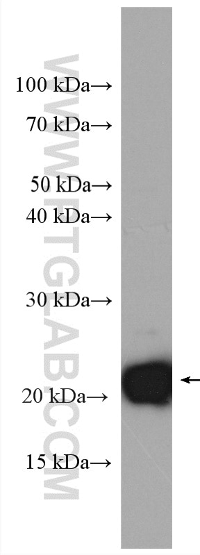 Western Blot (WB) analysis of mouse brain tissue using KRAS-2B-specific Polyclonal antibody (16155-1-AP)