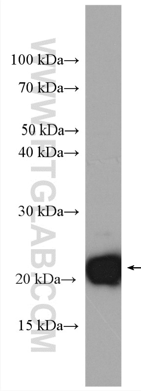 WB analysis of mouse brain using 16155-1-AP