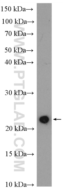 Western Blot (WB) analysis of HeLa cells using KRAS-2B-specific Polyclonal antibody (16155-1-AP)
