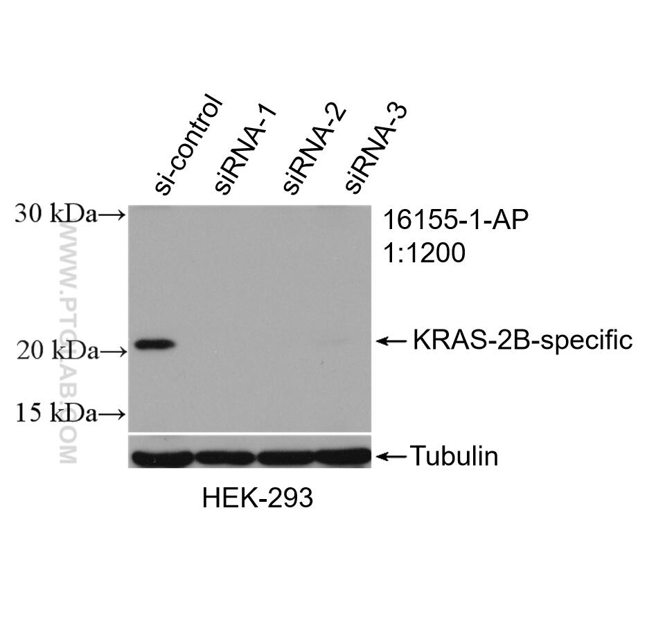 Western Blot (WB) analysis of HEK-293 cells using KRAS-2B-specific Polyclonal antibody (16155-1-AP)
