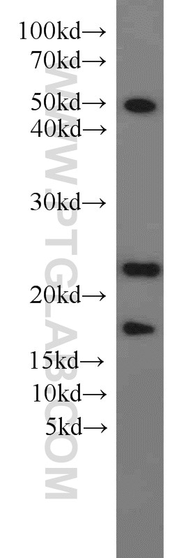 Western Blot (WB) analysis of mouse kidney tissue using KRAS-2B-specific Polyclonal antibody (16155-1-AP)