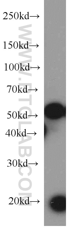 Western Blot (WB) analysis of MCF-7 cells using KRAS-2B-specific Polyclonal antibody (16155-1-AP)