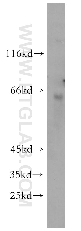 Western Blot (WB) analysis of mouse liver tissue using KRBP Polyclonal antibody (10386-1-AP)