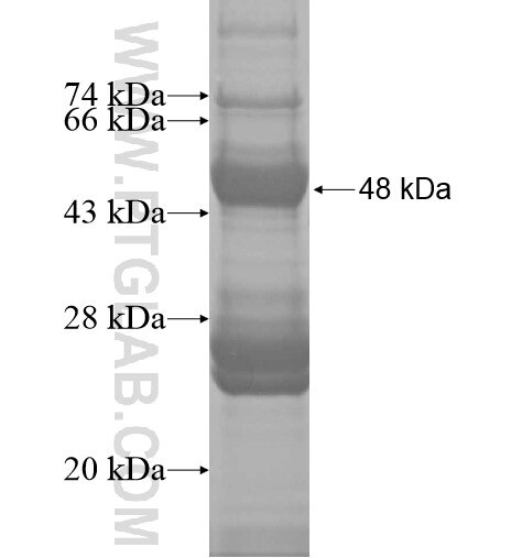 KRCC1 fusion protein Ag10157 SDS-PAGE