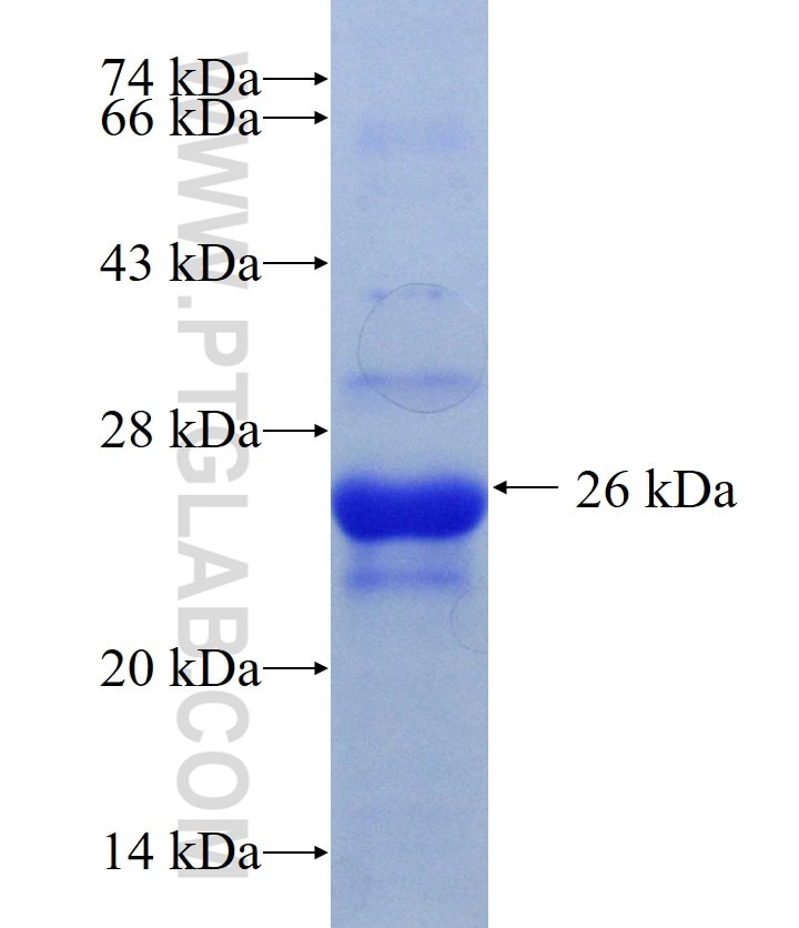 KRCC1 fusion protein Ag10204 SDS-PAGE