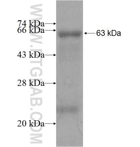 KREMEN2 fusion protein Ag7765 SDS-PAGE