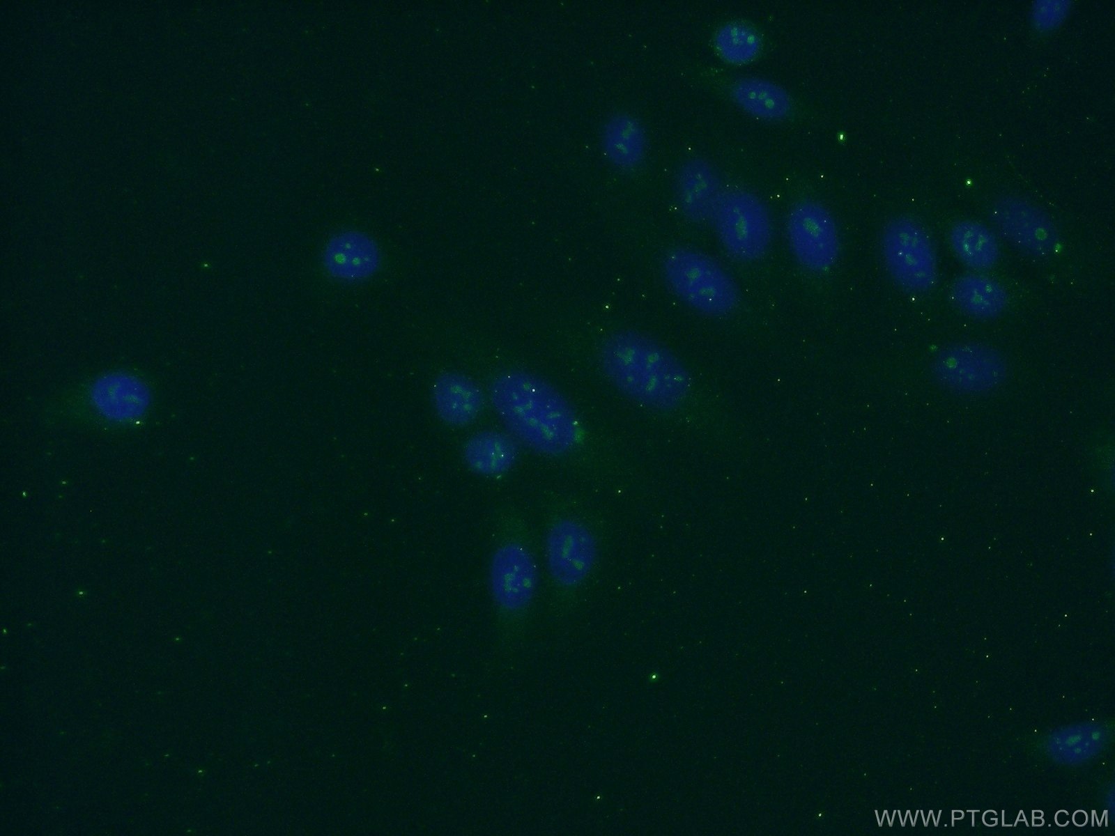 Immunofluorescence (IF) / fluorescent staining of HepG2 cells using KRI1 Polyclonal antibody (16243-1-AP)