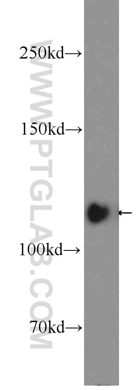 Western Blot (WB) analysis of HeLa cells using KRI1 Polyclonal antibody (16243-1-AP)