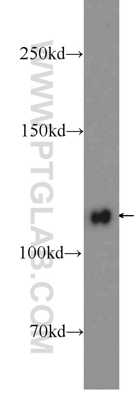 Western Blot (WB) analysis of HeLa cells using KRI1 Polyclonal antibody (16243-1-AP)