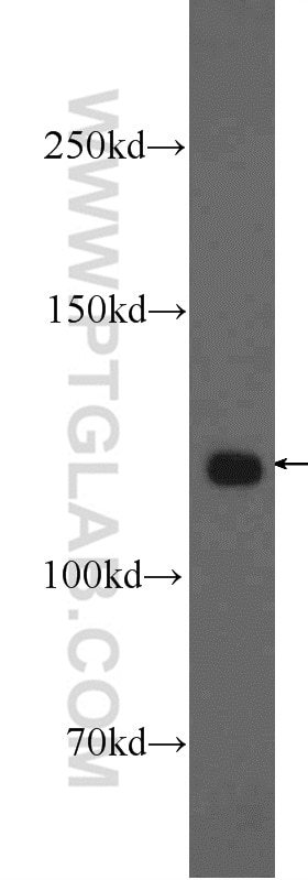 Western Blot (WB) analysis of HepG2 cells using KRI1 Polyclonal antibody (16243-1-AP)