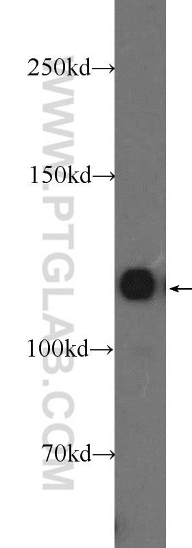 Western Blot (WB) analysis of HEK-293 cells using KRI1 Polyclonal antibody (16243-1-AP)
