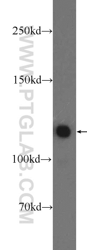 Western Blot (WB) analysis of HEK-293 cells using KRI1 Polyclonal antibody (16243-1-AP)