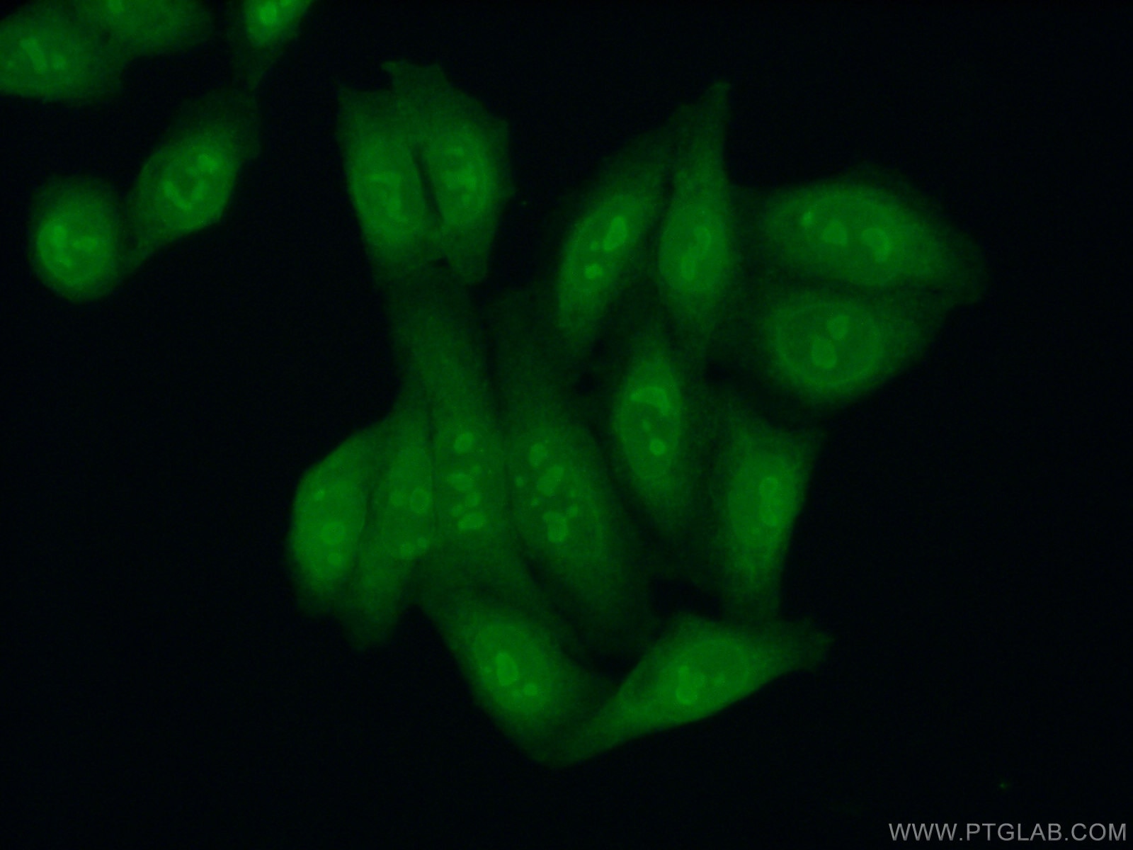 Immunofluorescence (IF) / fluorescent staining of HepG2 cells using KRR1 Polyclonal antibody (12772-1-AP)