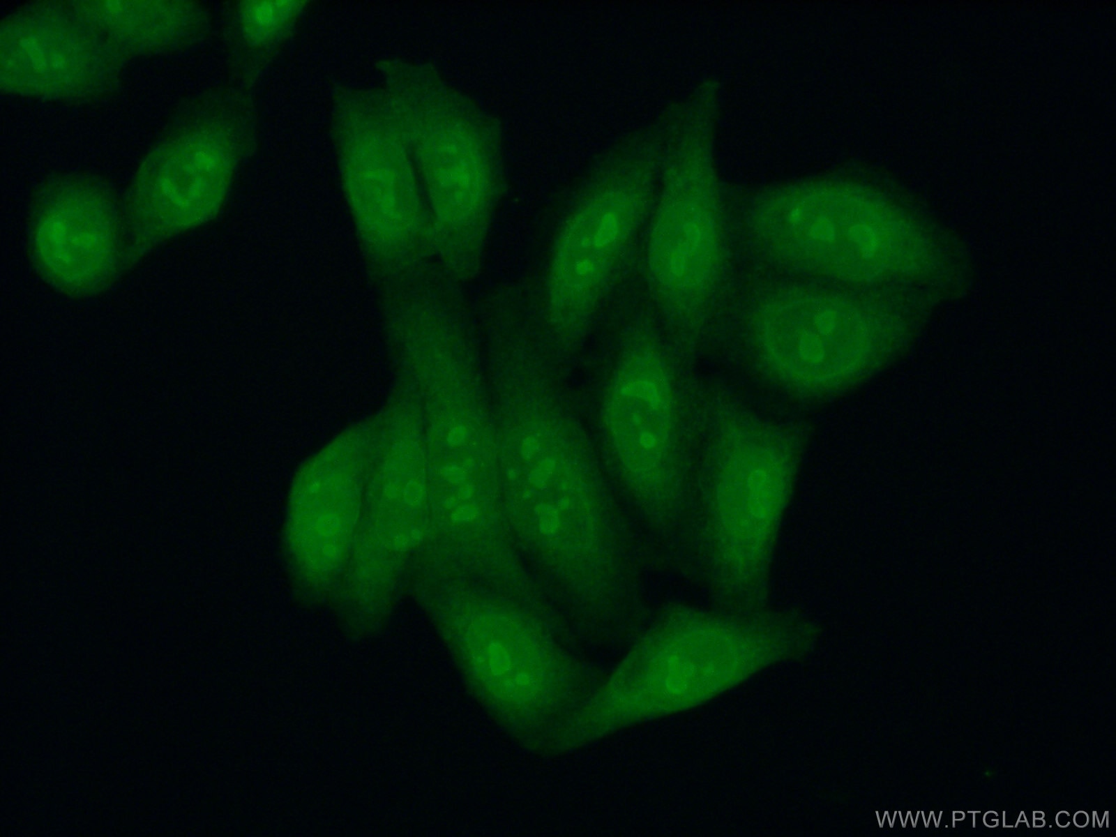 Immunofluorescence (IF) / fluorescent staining of HepG2 cells using KRR1 Polyclonal antibody (12772-1-AP)
