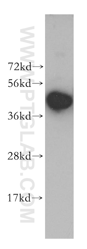 Western Blot (WB) analysis of human brain tissue using KRR1 Polyclonal antibody (12772-1-AP)