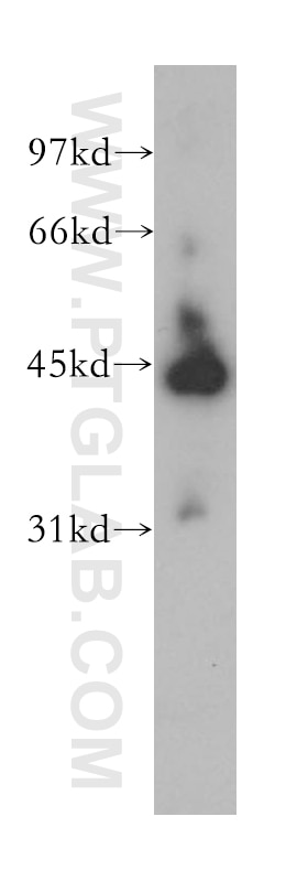 Western Blot (WB) analysis of human kidney tissue using KRR1 Polyclonal antibody (12772-1-AP)