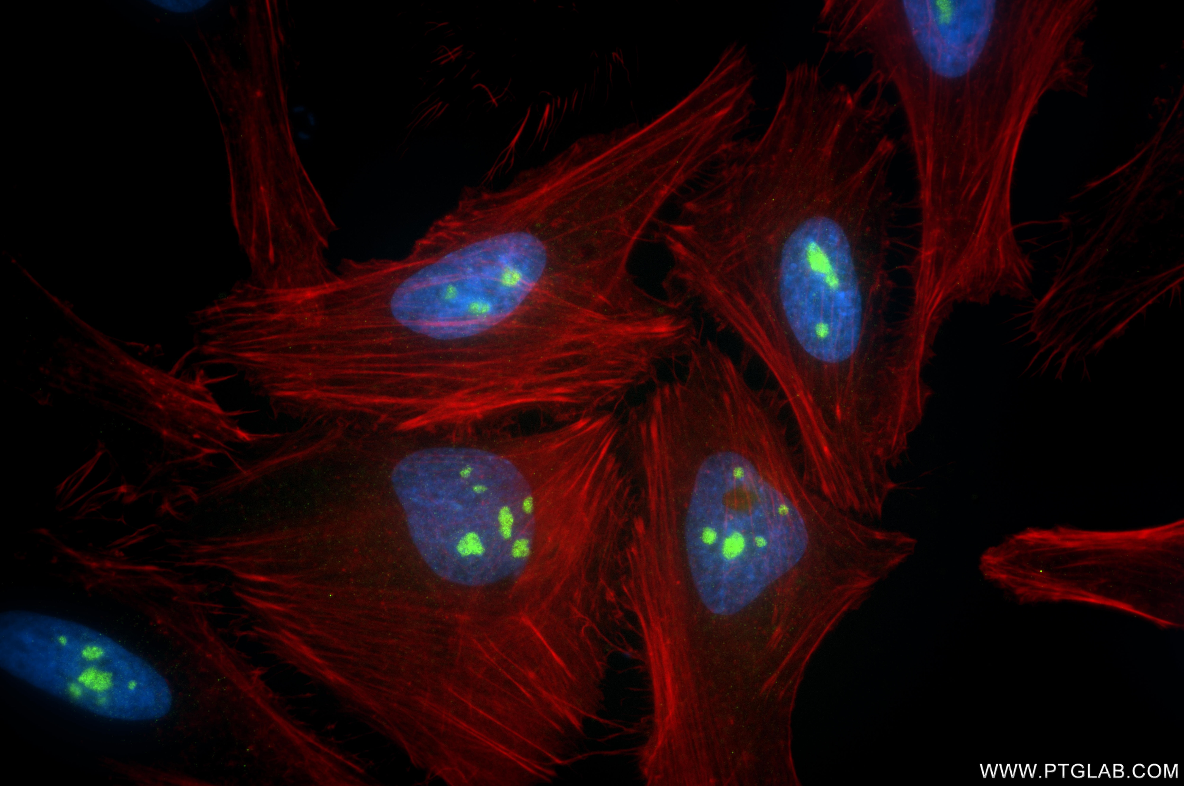 Immunofluorescent analysis of (4% PFA) fixed HeLa cells using KRR1 antibody (86993-3-RR, Clone: 252034F1 ) at dilution of 1:1000 and CoraLite®488-Conjugated Goat Anti-Rabbit IgG(H+L) (SA00013-2), CL594-Phalloidin (red). Immunofluorescence (IF) / fluorescent staining of HeLa cells using KRR1 Recombinant monoclonal antibody (86993-3-RR)