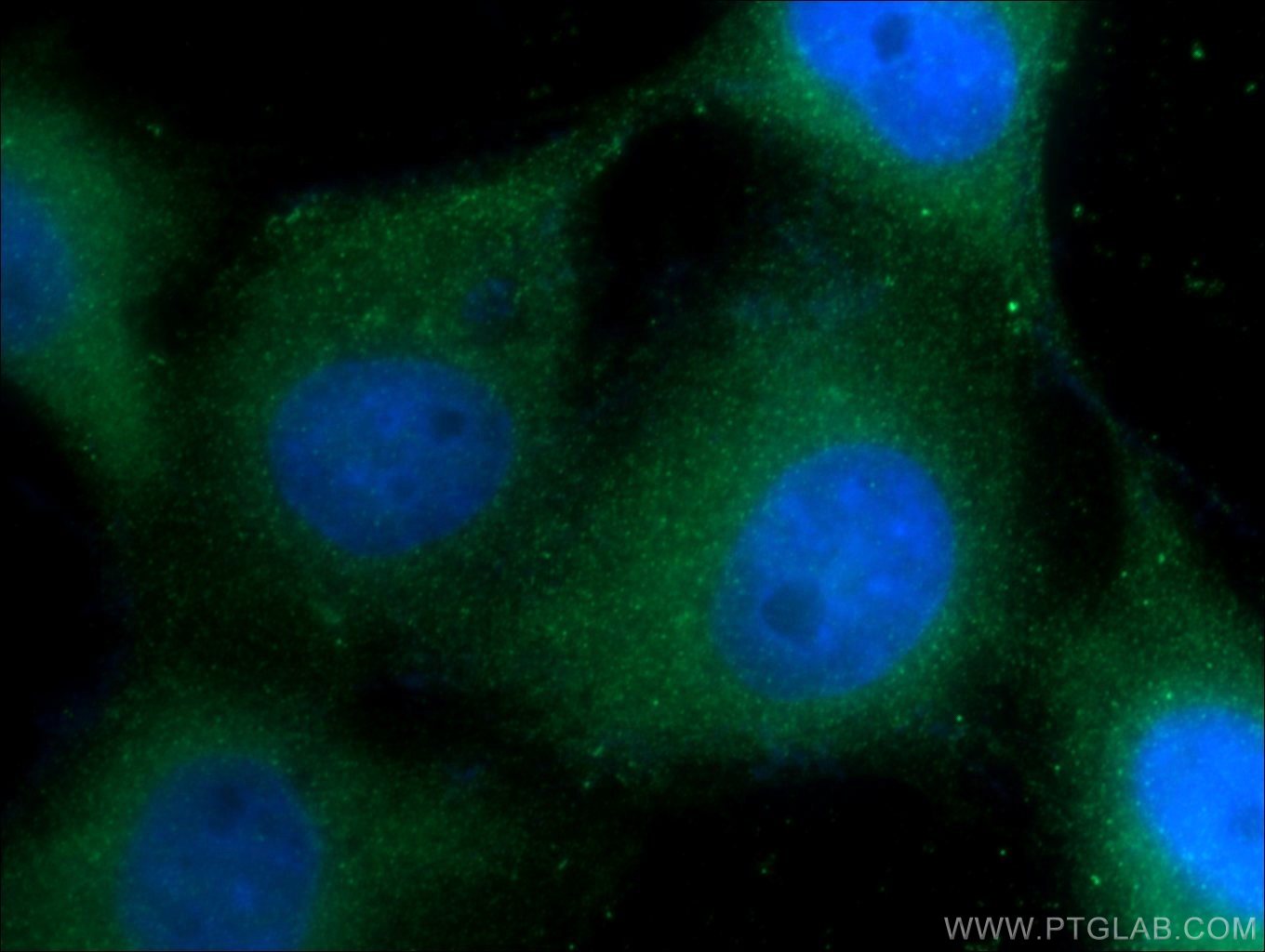 Immunofluorescence (IF) / fluorescent staining of A431 cells using Cytokeratin 1-specific Polyclonal antibody (16848-1-AP)
