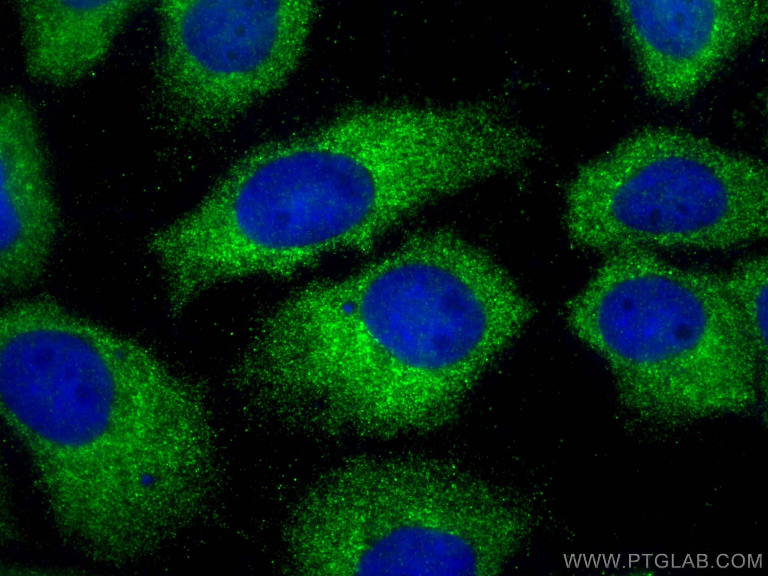Immunofluorescence (IF) / fluorescent staining of A431 cells using Cytokeratin 1-specific Polyclonal antibody (16848-1-AP)